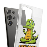 Nervous Rex — Snap Phone Case